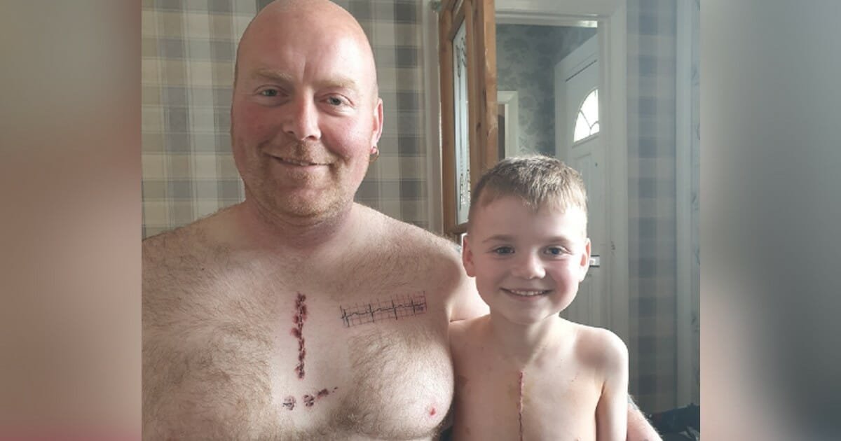 Dad gets tattoo to match 6-year-old son's scar from life-saving surgery