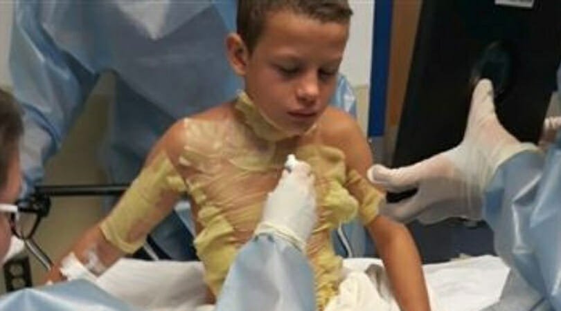12-year-old boy left with serious burns after friends set him on fire – mom issues warning over new trend