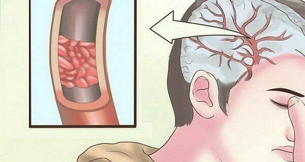 13 warning signs your body is lacking vitamin D