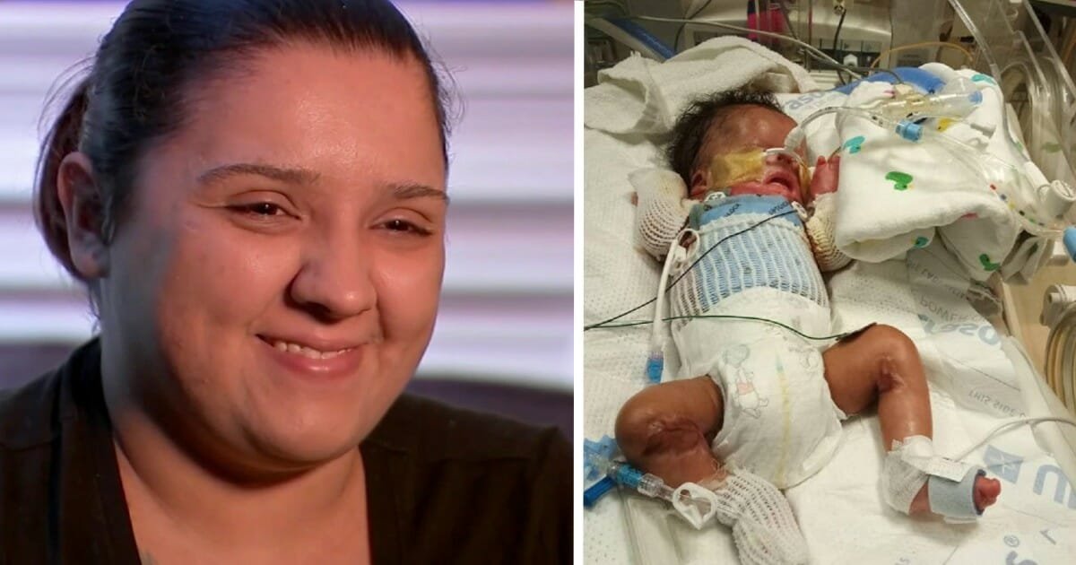 Baby born without skin held and kissed for the first time after successful transplant