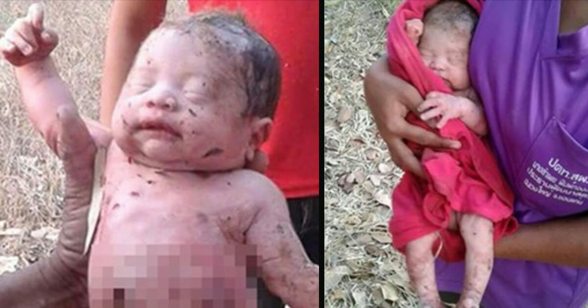 Baby survives being stabbed 14 times and buried alive by his birth mom – let’s show him our support