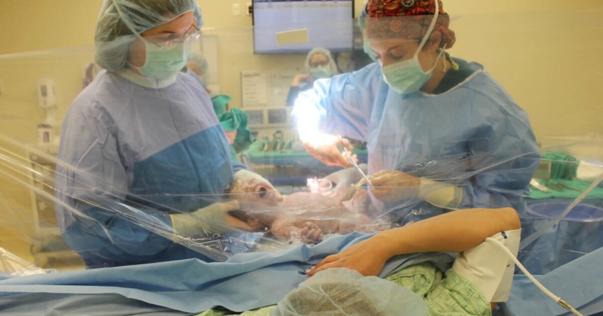 Clear drapes allow mothers to watch the birth of their child via C-section