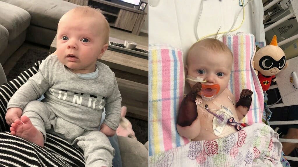 Baby loses both hands after developing rash on holiday – doctors have no idea how to treat his rare condition