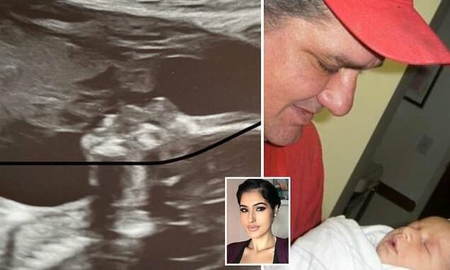 Mom left shocked after ”spotting her late father kissing her unborn daughter” in ultrasound