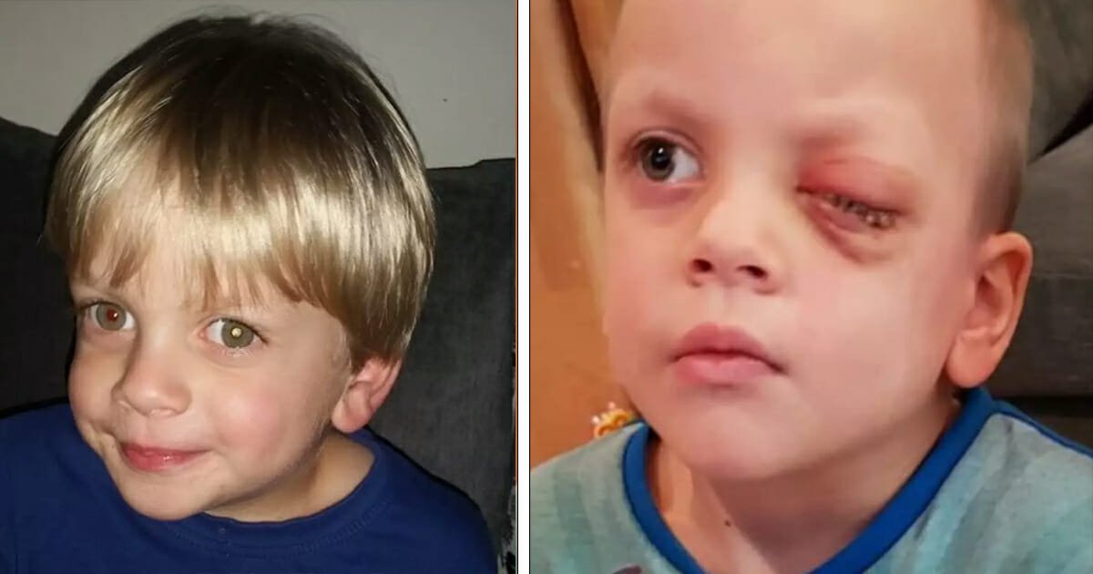 4-year-old boy has eye removed over Christmas after mom finds rare cancer in photo