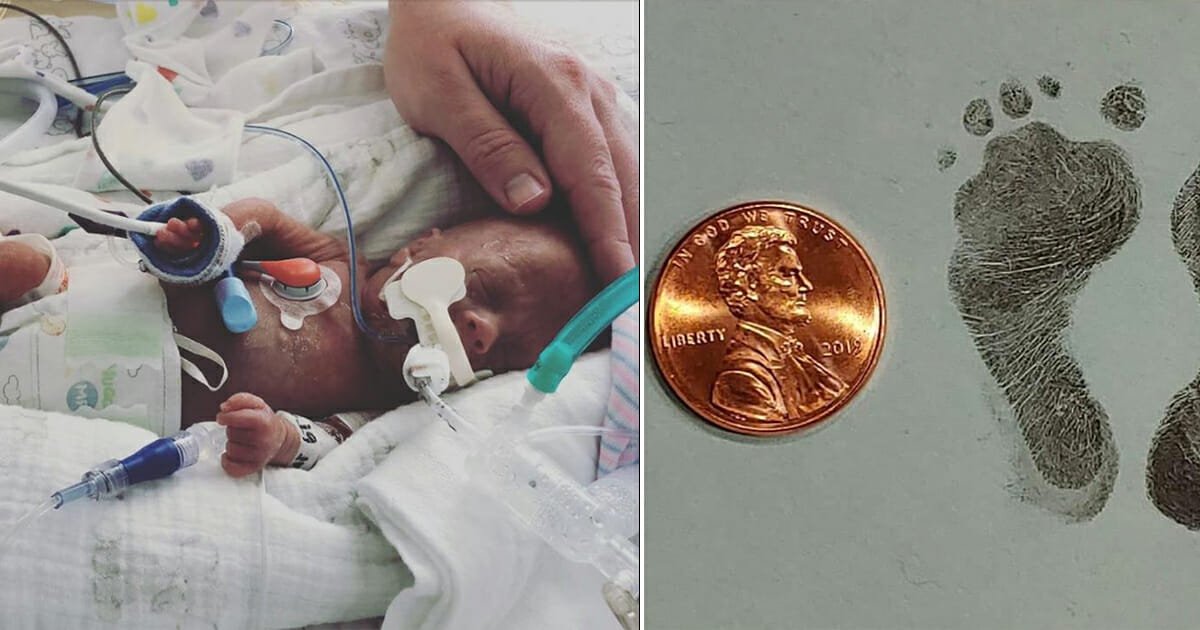 Micro preemie born with feet small as a penny can finally go home after 113 days in NICU