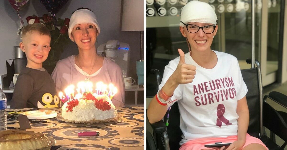 Single mom has part of her skull removed after ruptured brain aneurysm and stroke