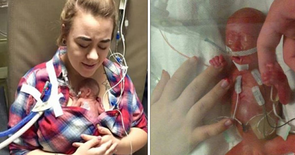 Three babies died in mom's womb as she carried them to term in order to save their sister