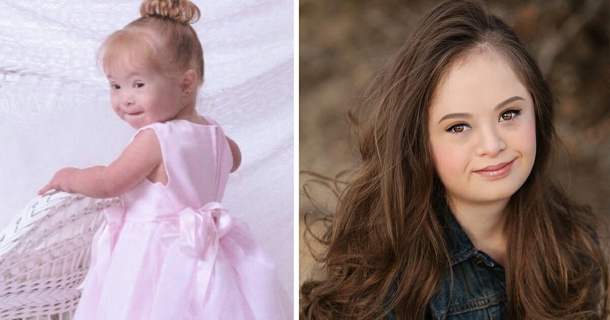 Girl with Down syndrome, who doctors told mom to put in an institution, becomes top model