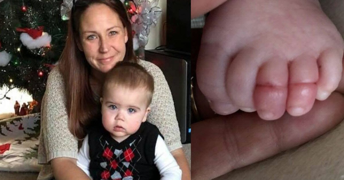 Mom finds angry red swelling on 2-week-old, wants parents to check babies' toes very carefully